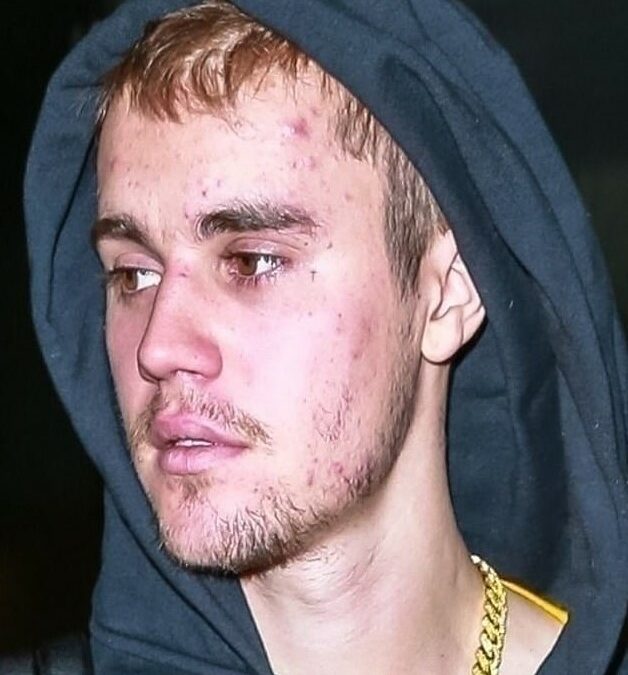 Justin Bieber Diagnosed With Lyme Disease Insists I Am Not On Meth Jim Heath Tv 